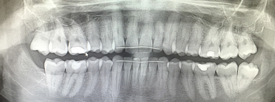 wisdom Cosmetic Dentist Glasgow