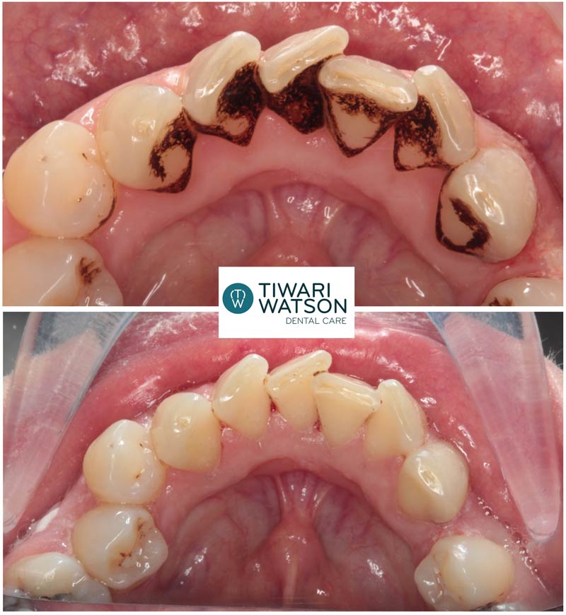 dental_hygiene